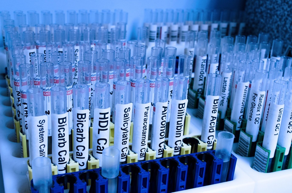 image of test tubes